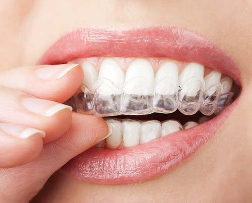 A confident, happy patient after Invisalign treatment