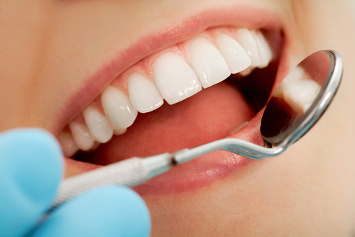 Cleanings at Cadena Family Dentistry